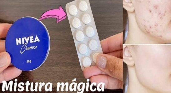 Rugas